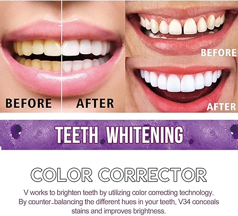 ✨ Teeth Whitening Toothpaste - 30ml | Gentle & Effective Stain Removal