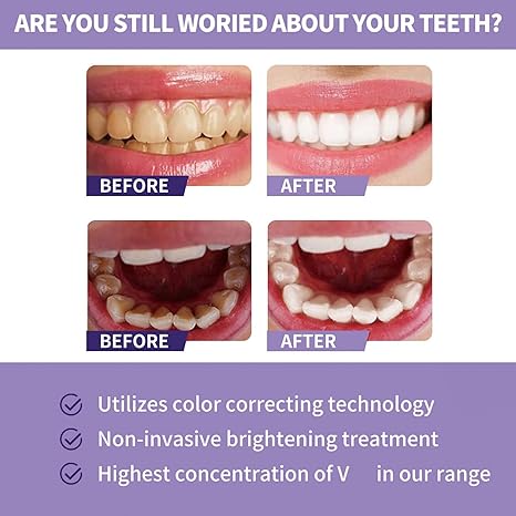 ✨ Teeth Whitening Toothpaste - 30ml | Gentle & Effective Stain Removal